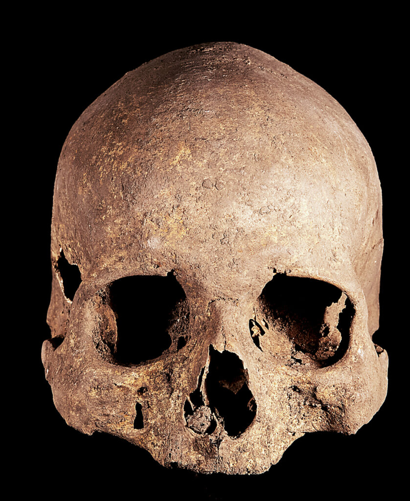 Cranio